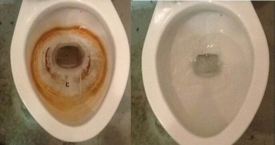 Vergilbte Toilettenschüssel voller Kalk, entfernen Sie alles mit dieser